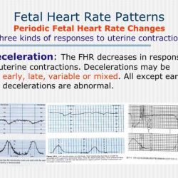 Relias fetal heart monitoring answers