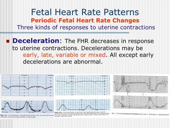 Relias fetal heart monitoring answers